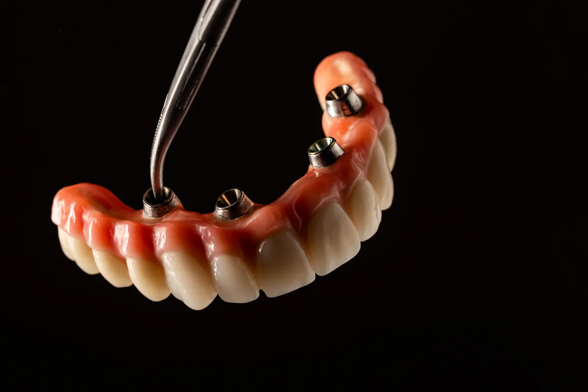 Lucrări Mobilizabile - dentalbit dental bit tg mureș laborator tehnică dentară laborator tehnica dentara tg mures mures fogtechnikus marosvasarhely fogtechnia CAD/CAM exocad digital Laborator Tehnică Dentară Proiectare Digitală Dentară Lucrări Fixe Lucrări Fixe Pe Implant Lucrări Mobile Lucrări Mobilizabile tehnică dentară digitală