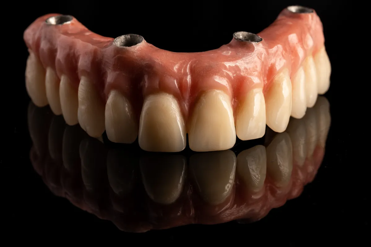 Lucrări Mobilizabile - dentalbit dental bit tg mureș laborator tehnică dentară laborator tehnica dentara tg mures mures fogtechnikus marosvasarhely fogtechnia CAD/CAM exocad digital Laborator Tehnică Dentară Proiectare Digitală Dentară Lucrări Fixe Lucrări Fixe Pe Implant Lucrări Mobile Lucrări Mobilizabile tehnică dentară digitală