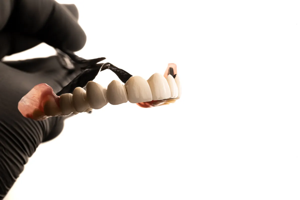 Lucrări Mobilizabile - dentalbit dental bit tg mureș laborator tehnică dentară laborator tehnica dentara tg mures mures fogtechnikus marosvasarhely fogtechnia CAD/CAM exocad digital Laborator Tehnică Dentară Proiectare Digitală Dentară Lucrări Fixe Lucrări Fixe Pe Implant Lucrări Mobile Lucrări Mobilizabile tehnică dentară digitală