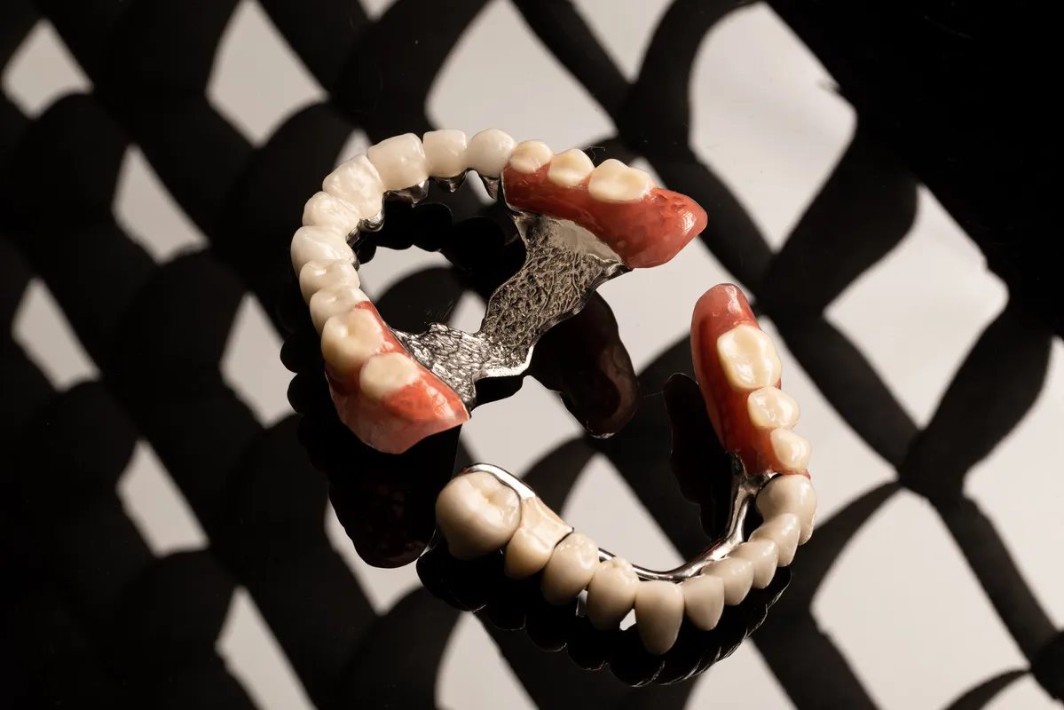 Lucrări Mobilizabile - dentalbit dental bit tg mureș laborator tehnică dentară laborator tehnica dentara tg mures mures fogtechnikus marosvasarhely fogtechnia CAD/CAM exocad digital Laborator Tehnică Dentară Proiectare Digitală Dentară Lucrări Fixe Lucrări Fixe Pe Implant Lucrări Mobile Lucrări Mobilizabile tehnică dentară digitală