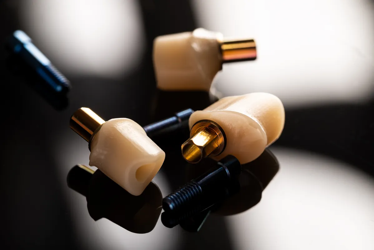 Lucrări Fixe pe Implant - dentalbit dental bit tg mureș laborator tehnică dentară laborator tehnica dentara tg mures mures fogtechnikus marosvasarhely fogtechnia CAD/CAM exocad digital Laborator Tehnică Dentară Proiectare Digitală Dentară Lucrări Fixe Lucrări Fixe Pe Implant Lucrări Mobile Lucrări Mobilizabile tehnică dentară digitală