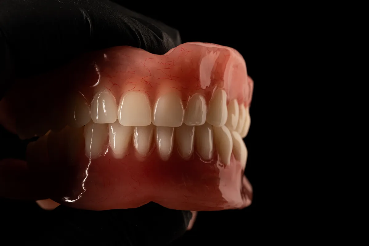 Lucrări Mobile - dentalbit dental bit tg mureș laborator tehnică dentară laborator tehnica dentara tg mures mures fogtechnikus marosvasarhely fogtechnia CAD/CAM exocad digital Laborator Tehnică Dentară Proiectare Digitală Dentară Lucrări Fixe Lucrări Fixe Pe Implant Lucrări Mobile Lucrări Mobilizabile tehnică dentară digitală