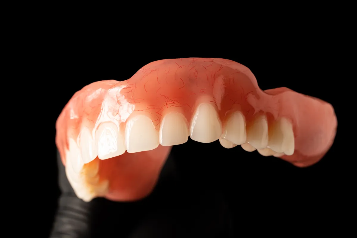 Lucrări Mobile - dentalbit dental bit tg mureș laborator tehnică dentară laborator tehnica dentara tg mures mures fogtechnikus marosvasarhely fogtechnia CAD/CAM exocad digital Laborator Tehnică Dentară Proiectare Digitală Dentară Lucrări Fixe Lucrări Fixe Pe Implant Lucrări Mobile Lucrări Mobilizabile tehnică dentară digitală