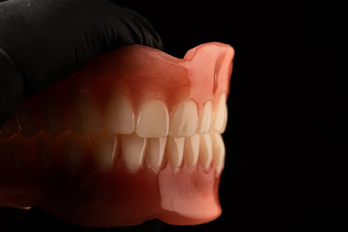 Lucrări Mobile - dentalbit dental bit tg mureș laborator tehnică dentară laborator tehnica dentara tg mures mures fogtechnikus marosvasarhely fogtechnia CAD/CAM exocad digital Laborator Tehnică Dentară Proiectare Digitală Dentară Lucrări Fixe Lucrări Fixe Pe Implant Lucrări Mobile Lucrări Mobilizabile tehnică dentară digitală