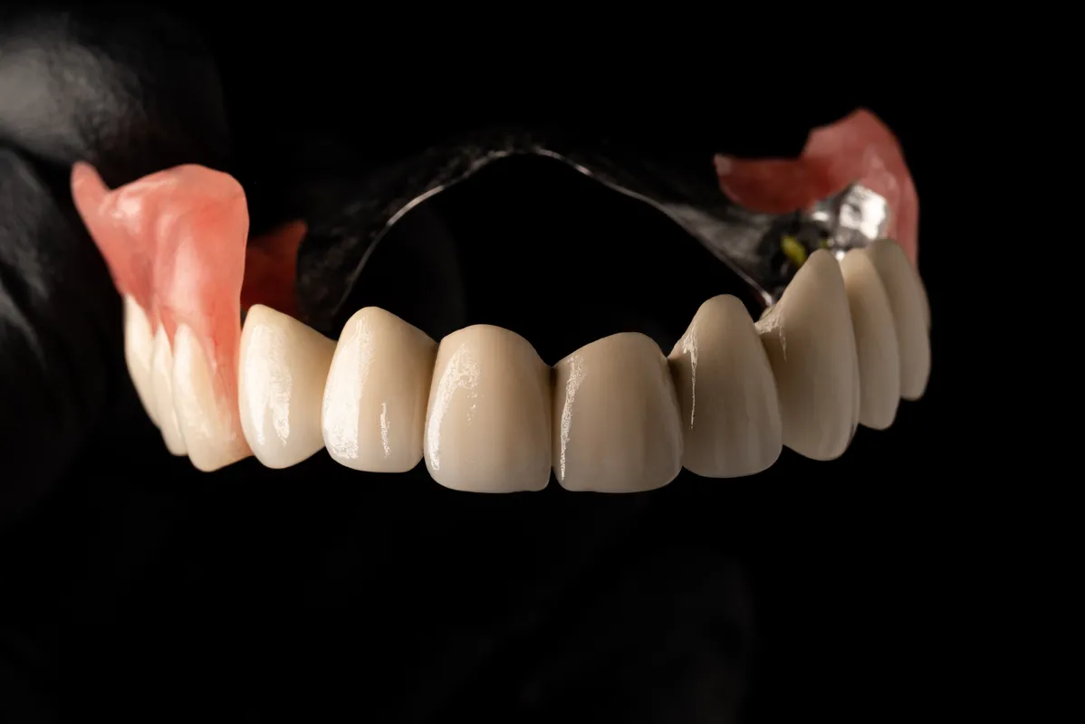 Lucrări Mobilizabile - dentalbit dental bit tg mureș laborator tehnică dentară laborator tehnica dentara tg mures mures fogtechnikus marosvasarhely fogtechnia CAD/CAM exocad digital Laborator Tehnică Dentară Proiectare Digitală Dentară Lucrări Fixe Lucrări Fixe Pe Implant Lucrări Mobile Lucrări Mobilizabile tehnică dentară digitală
