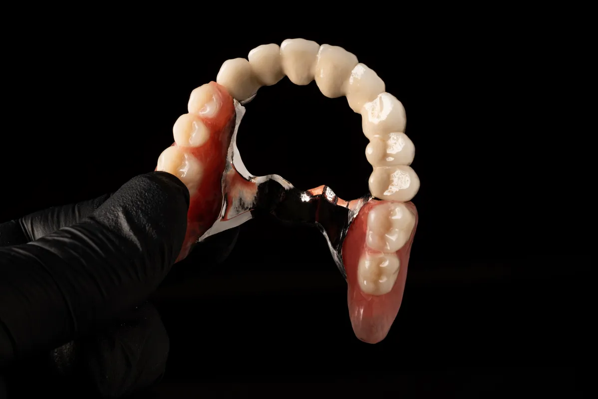 Lucrări Mobilizabile - dentalbit dental bit tg mureș laborator tehnică dentară laborator tehnica dentara tg mures mures fogtechnikus marosvasarhely fogtechnia CAD/CAM exocad digital Laborator Tehnică Dentară Proiectare Digitală Dentară Lucrări Fixe Lucrări Fixe Pe Implant Lucrări Mobile Lucrări Mobilizabile tehnică dentară digitală