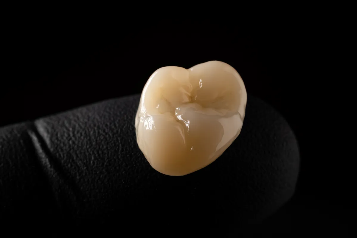 Lucrări Fixe - dentalbit dental bit tg mureș laborator tehnică dentară laborator tehnica dentara tg mures mures fogtechnikus marosvasarhely fogtechnia CAD/CAM exocad digital Laborator Tehnică Dentară Proiectare Digitală Dentară Lucrări Fixe Lucrări Fixe Pe Implant Lucrări Mobile Lucrări Mobilizabile tehnică dentară digitală