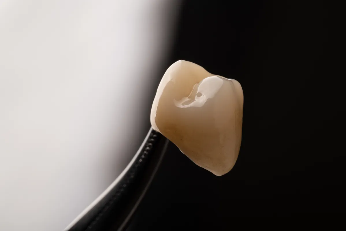 Lucrări Fixe - dentalbit dental bit tg mureș laborator tehnică dentară laborator tehnica dentara tg mures mures fogtechnikus marosvasarhely fogtechnia CAD/CAM exocad digital Laborator Tehnică Dentară Proiectare Digitală Dentară Lucrări Fixe Lucrări Fixe Pe Implant Lucrări Mobile Lucrări Mobilizabile tehnică dentară digitală