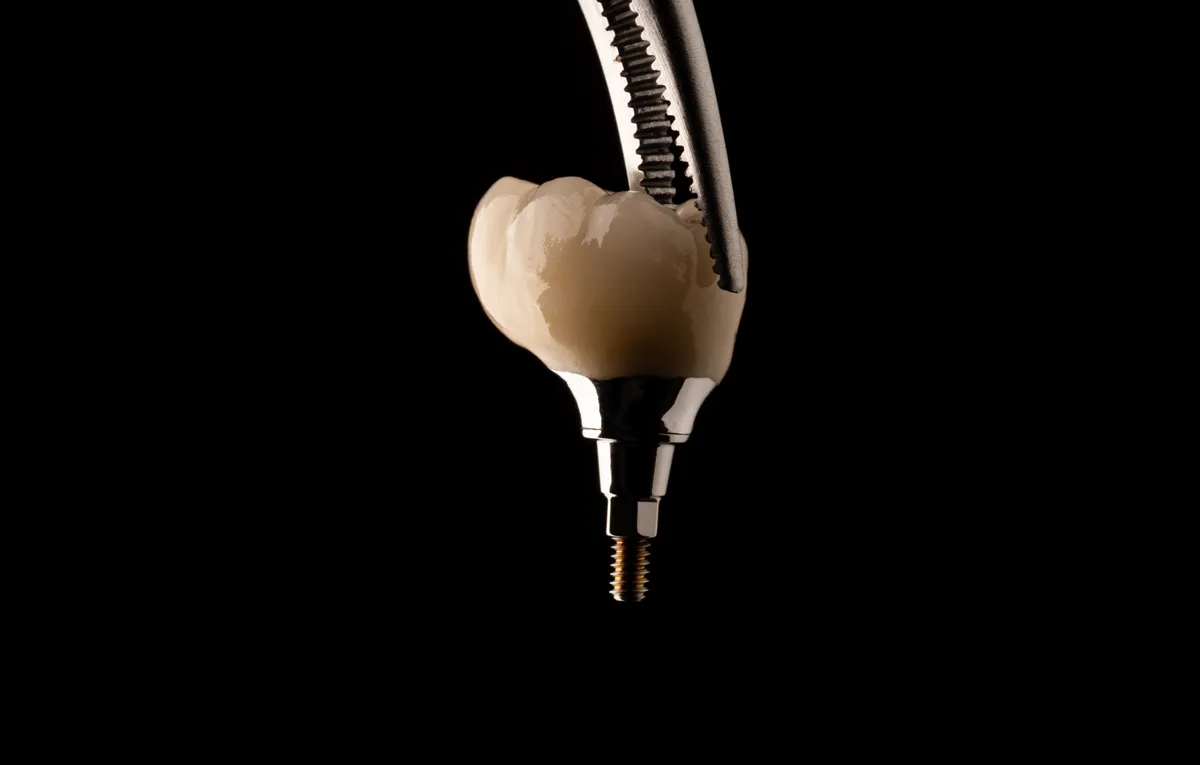 Lucrări Fixe pe Implant - dentalbit dental bit tg mureș laborator tehnică dentară laborator tehnica dentara tg mures mures fogtechnikus marosvasarhely fogtechnia CAD/CAM exocad digital Laborator Tehnică Dentară Proiectare Digitală Dentară Lucrări Fixe Lucrări Fixe Pe Implant Lucrări Mobile Lucrări Mobilizabile tehnică dentară digitală