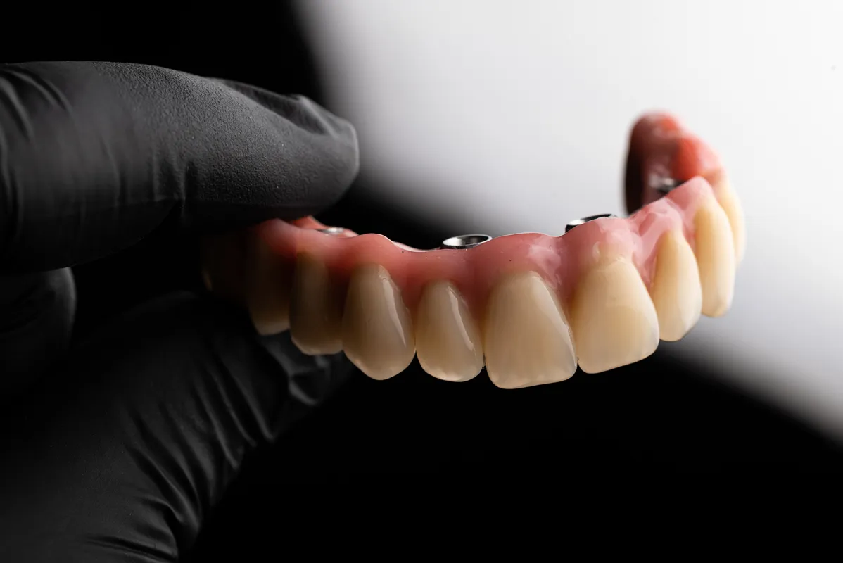 Lucrări Mobilizabile - dentalbit dental bit tg mureș laborator tehnică dentară laborator tehnica dentara tg mures mures fogtechnikus marosvasarhely fogtechnia CAD/CAM exocad digital Laborator Tehnică Dentară Proiectare Digitală Dentară Lucrări Fixe Lucrări Fixe Pe Implant Lucrări Mobile Lucrări Mobilizabile tehnică dentară digitală