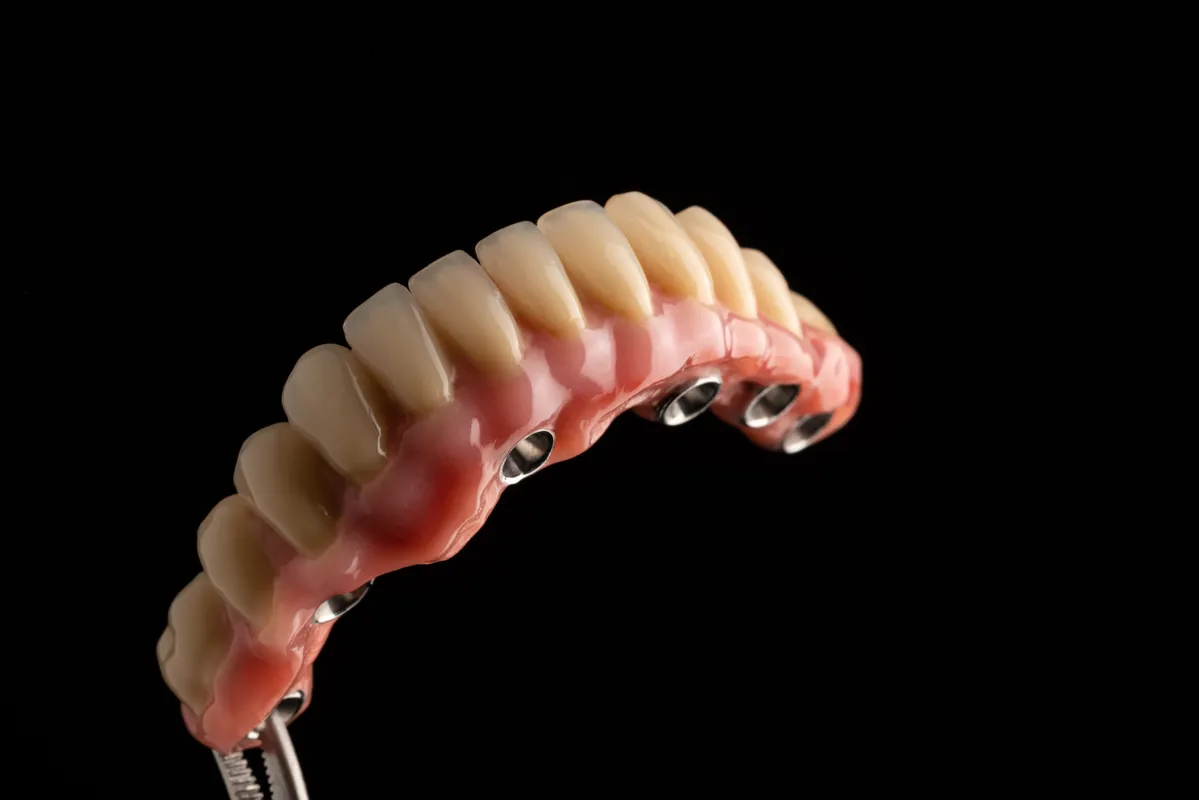 Lucrări Mobilizabile - dentalbit dental bit tg mureș laborator tehnică dentară laborator tehnica dentara tg mures mures fogtechnikus marosvasarhely fogtechnia CAD/CAM exocad digital Laborator Tehnică Dentară Proiectare Digitală Dentară Lucrări Fixe Lucrări Fixe Pe Implant Lucrări Mobile Lucrări Mobilizabile tehnică dentară digitală