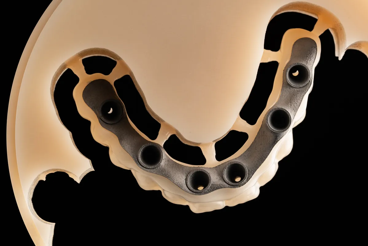 Lucrări Mobilizabile - dentalbit dental bit tg mureș laborator tehnică dentară laborator tehnica dentara tg mures mures fogtechnikus marosvasarhely fogtechnia CAD/CAM exocad digital Laborator Tehnică Dentară Proiectare Digitală Dentară Lucrări Fixe Lucrări Fixe Pe Implant Lucrări Mobile Lucrări Mobilizabile tehnică dentară digitală
