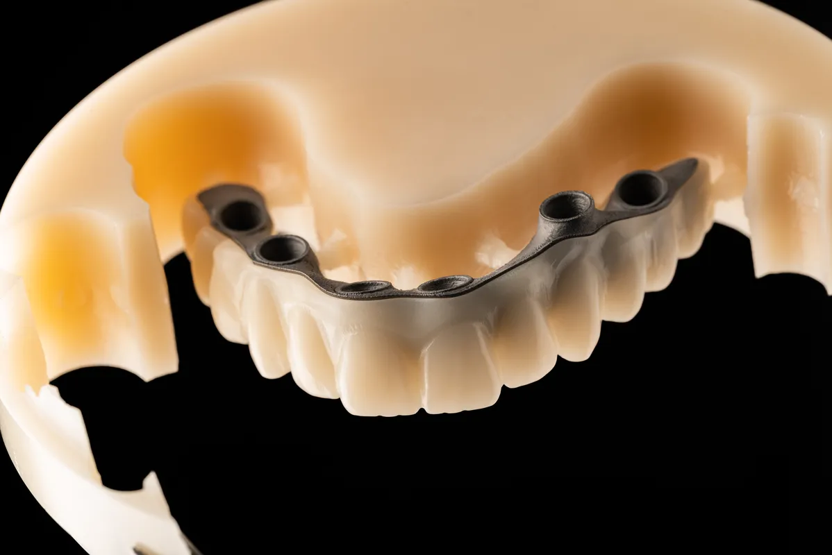 Lucrări Mobilizabile - dentalbit dental bit tg mureș laborator tehnică dentară laborator tehnica dentara tg mures mures fogtechnikus marosvasarhely fogtechnia CAD/CAM exocad digital Laborator Tehnică Dentară Proiectare Digitală Dentară Lucrări Fixe Lucrări Fixe Pe Implant Lucrări Mobile Lucrări Mobilizabile tehnică dentară digitală