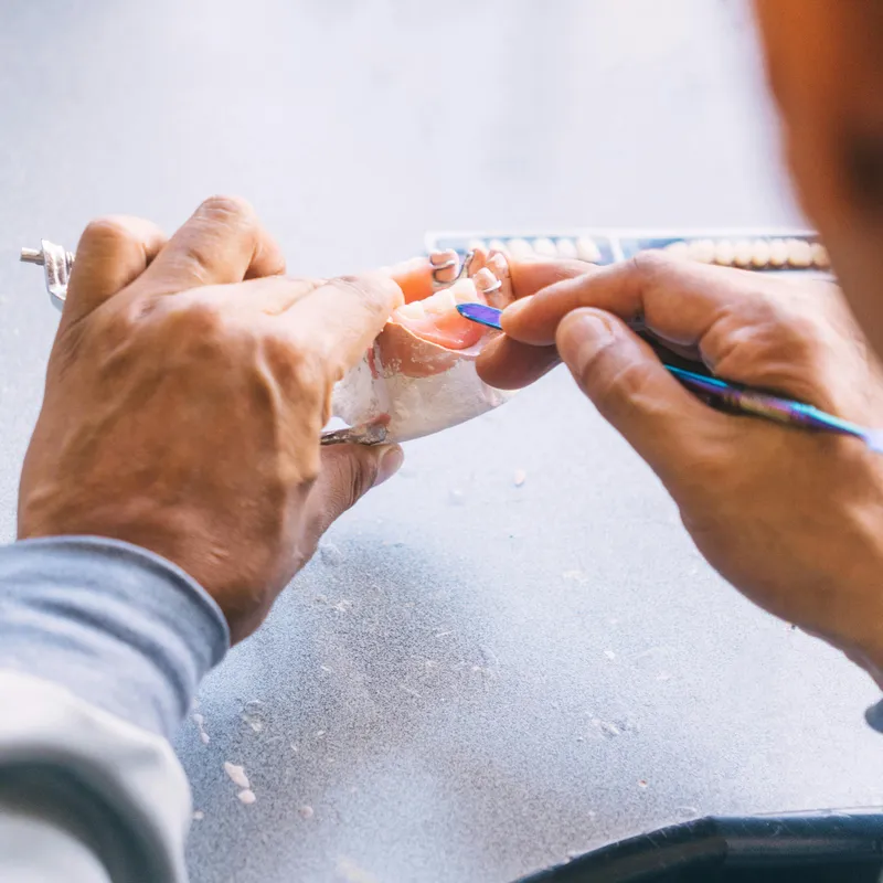 - dentalbit dental bit tg mureș laborator tehnică dentară laborator tehnica dentara tg mures mures fogtechnikus marosvasarhely fogtechnia CAD/CAM exocad digital Laborator Tehnică Dentară Proiectare Digitală Dentară Lucrări Fixe Lucrări Fixe Pe Implant Lucrări Mobile Lucrări Mobilizabile tehnică dentară digitală